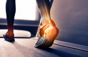Flavonoids and Bone Health
