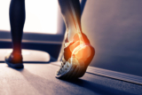 Flavonoids and Bone Health