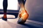 Flavonoids and Bone Health