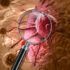 Flavonoids and Bone Health